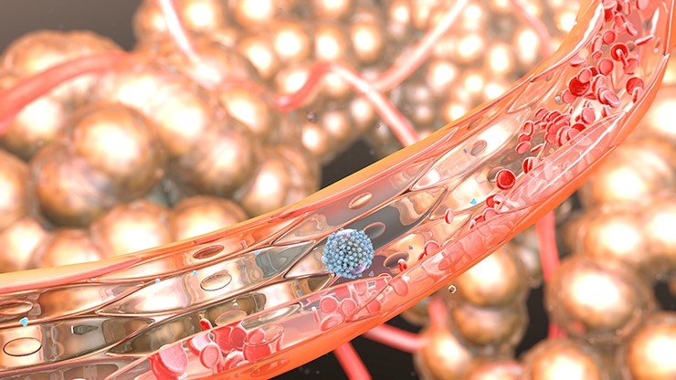Метастатическая раковая клетка в кровеносном сосуде. Чтобы выжить в кровотоке, клетка активирует тромбоциты, которые создают вокруг нее защитную оболочку. Это один из механизмов противодействия иммунному ответу. Изображение студии медицинской анимации Nanobotmodels Medical Animation Studio