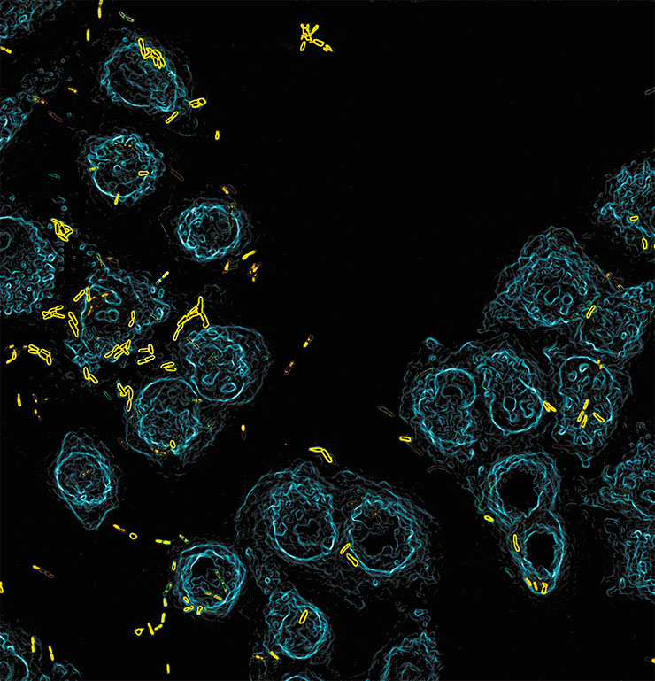 The pathogenic bacterium Pseudomonas aeruginosa activates their virulence programme as early as 20 s after contact with a host. Right: Pseudomonas aeruginosa (in yellow) colonizing a culture of lung epithelial cells. © CC BY 4.0 /Benoit-Joseph Laventie