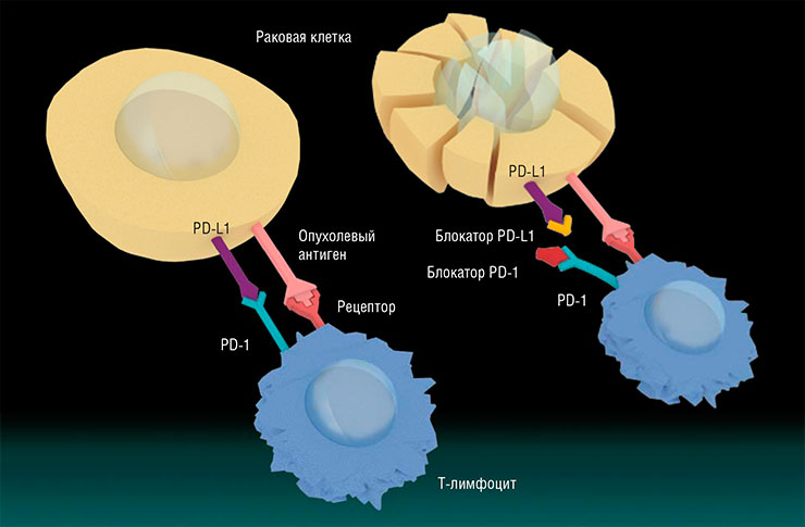 T-лимфоциты несут рецептор PD1, который при связывании с такими белками, как PD-L1, помогает контролировать иммунный ответ. Опухолевые клетки, защищаясь, сами производят большое количество белков PD-L1, снижая активность Т-клеток (слева). Блокирование связывания PD-L1 с PD-1 с помощью антител-блокаторов снимает эту защиту, позволяя Т-киллерам убивать раковые клетки (справа). По: (Terese Winslow LLC, Medical And Scientific Illustration, 2015)