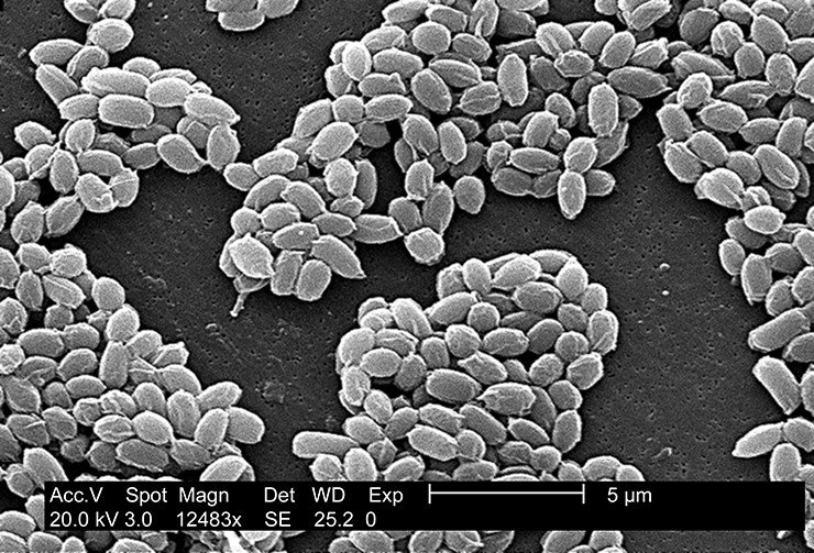 Белковые оболочки спор бацилл сибирской язвы штамма Sterne Б. отличаются морщинистой поверхностью. Споры сохраняют жизнеспособность в течение многих лет, и в таком неактивном виде бактерии способны выдерживать резкие или неблагоприятные условия, которые обычно их убивают.Сканирующий электронный микроскоп. CDC, Public Domain