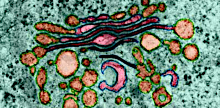 В аппарате Гольджи гликозилированные белки и липиды упаковываются в мембранные пузырьки, которые затем отделяются и перемещаются «в место назначения». ©CC BY-NC-SA 2.0/Erin Hass. Внизу – схематичное изображение этой внутриклеточной органеллы