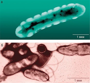 Клетки водородных бактерий в режиме накопления биополимеров (а) и реализующие «белковую программу» (б)