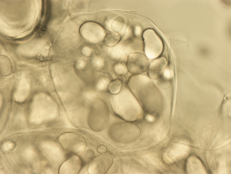 Уникальные черные пластиды (меланопласты) в клетках зерен ячменя содержат пигмент меланин (вверху). Они способны к фотосинтезу благодаря наличию хлорофилла. А бесцветные пластиды (амилопласты) в клетках клубня картофеля играют роль «кладовых» – они набиты зернами крахмала. Фото автора 
