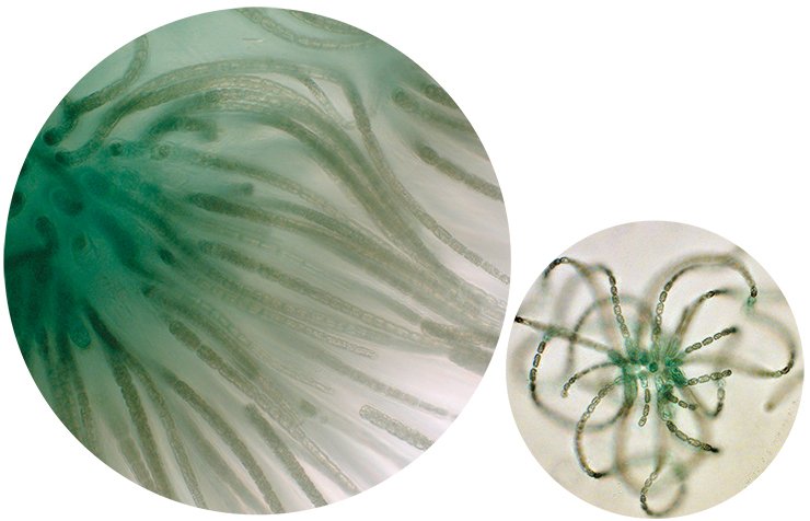 In the past the “safe” type of cyanobacteria, Gloeotrichia echinulata, dominated the Lake Kotokelskoye, but now it has given way to toxic representatives of the Anabaena and Microcystis genera (on the right, A. lemmermannii)