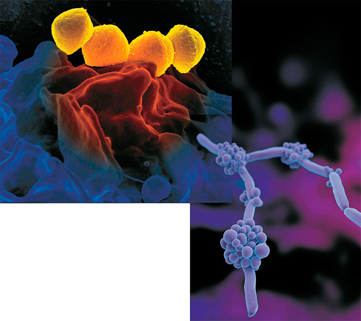 Слева: один из широко распространенных одноклеточных патогенов человека – бактерия бета-гемолитический стафилокок Staphylococcus haemolyticus на поверхности нейтрофила, клетки крови. Public Domain/NIAID. В отличие от бактерий, грибы относятся к высшим эукариотическим (ядерным) организмам. Справа: прикрепленные к нитям-гифам скопления репродуктивных клеток микроскопического гриба рода Candida, устойчивого к антибиотикам. Public Domain/CDC/Antibiotic Resistance Coordination and Strategy Unit/Dan Higgins