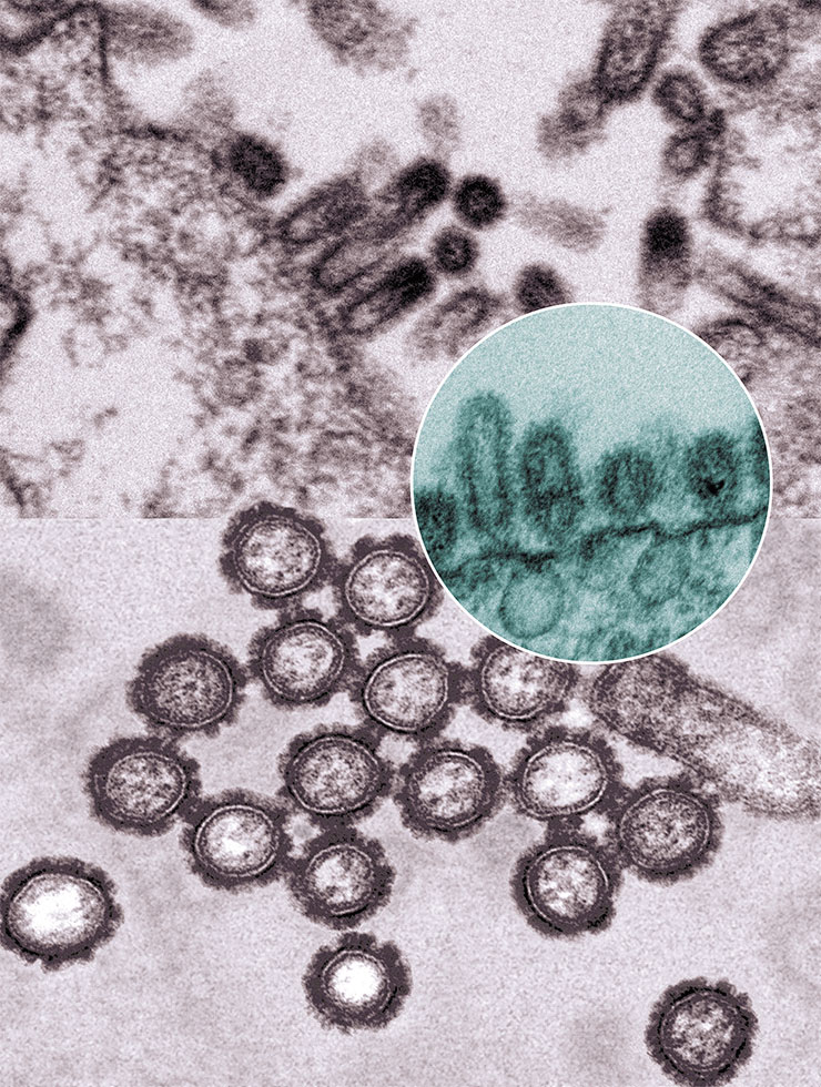 Почкование частиц вируса гриппа в зараженных клетках (вверху). В момент почкования вирионы имеют удлиненную форму; темные участки – рибонуклеопротеиновые комплексы. Фото Е. Рябчиковой (ИХБФМ СО РАН, Новосибирск). Внизу – частицы вируса гриппа H1N1. Именно этот серотип вызвал эпидемию «испанки», поразившей в 1918–1920 гг. свыше 550 млн человек. © CC BY-NC 2.0/National Institute of Allergy and Infectious Diseases, NIH