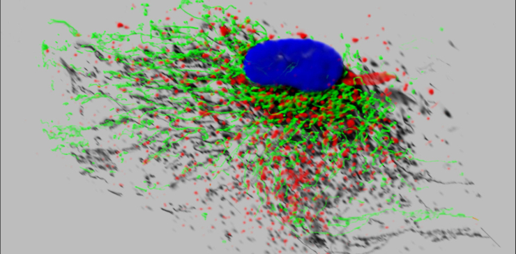 Стареющий фибробласт человека, для которого характерны большая сеть митохондрий (зеленым цветом) и множество лизосом (красным). Синим цветом показано клеточное ядро (ДНК) ©CC BY-NC-SA 2.0/Glyn Nelson