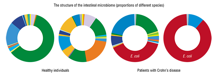 One of the well-established imbalances in the intestinal microbiota in Crohn’s disease is connected with the number of E. coli: in 30–60% of such patients, the number of E. coli in the bowel is one or two orders of magnitude greater than in healthy individuals. Based on: (Gevers et al., 2014)