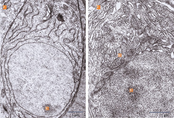 In comparison with (a) the inter-spawn period, (b) in the reproductive phase, the olfactory neurons of the yellowfin sculpin show the activation ofxnuclear-cytoplasmic interactions. The nucleolus (N), where ribosomes are synthesized, is close to the nuclear membrane, which acquires a higher pore density; mitochondria (M) adhere to the nuclear membrane