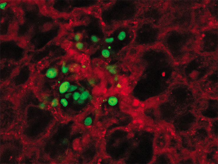 Cancer cells (stained green) leaving a blood vessel (stained red) and colonizing lung stroma. Multiphoton fluorescent microscopy. Microphotograph: A. M. Guiliani (Denmark)