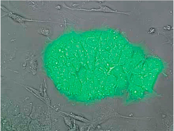 Эмбриональные стволовые клетки человека, экспрессирующие зеленый флуоресцирующий белок. Флуоресцентная микроскопия. Фото А. И. Шевченко и И. С. Захаровой