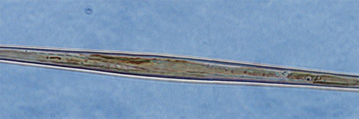 Диатомовая водоросль Synedra acus. Световая микроскопия