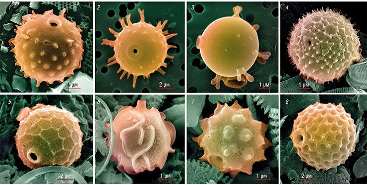Морфотипы стоматоцист очень разнообразны и видоспецифичны, но установить их видовую принадлежность крайне сложно, так как стоматоцисты совершенно не похожи на вегетирующие клетки, и их нужно культивировать в лабораторных условиях, что не всегда возможно. На фото – стоматоцисты из плиоценовых отложений оз. Байкал (1); планктона оз. Байкал (2, 3); голоценовых осадков оз. Эльгыгытгын (4); миоценовых осадков Охотского моря (5); голоцен-верхнеплейстоценовых осадков оз. Хубсугул (6, 7); миоценовых отложений Витимского плоскогорья (8)