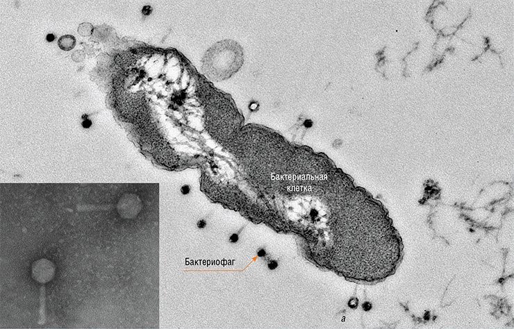 «Хвостатые» бактериофаги, нападающие на бактерию Pseudomonas aeruginosa (синегнойную палочку) Фото Е. И. Рябчиковой