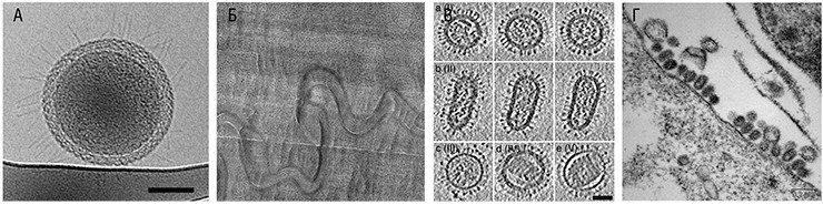Примеры объектов, визуализированных с помощью криоэлектронного микроскопа. А – очень мелкая бактерия, из тех, существование которых обсуждается и оспаривается. При помощи криомикроскопа удалось увидеть на ее поверхности тонкие волоски – филаменты, которые участвуют во взаимодействии с клетками животных и человека. Б – криосрез эпидермиса кожи, между клетками видны липидные структуры, которые другими методами не просматриваются. В – вирус гриппа, на его поверхности видны «шипики» – белки нейраминидазы и гемагглютинина, с помощью которых вирус взаимодействует с заражаемой клеткой. Г – изображение частиц вируса гриппа на поверхности клетки в «обычном» электронном микроскопе (для сравнения)
