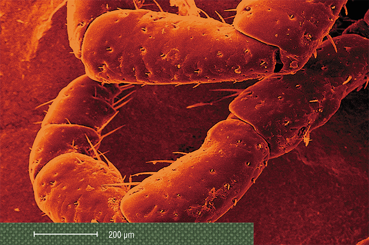 Morphological structures of the American dog tick (Dermacentor variabilis), one of the vectors of R. rickettsii: details of the mouth opening, dorsal sensory hair, and leg appendages. Scanning electron microscopy. © CDC, photo by J. H. Carr