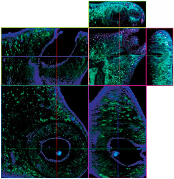 Teguments and individual organs of O. felineus. Laser scanning microscopy