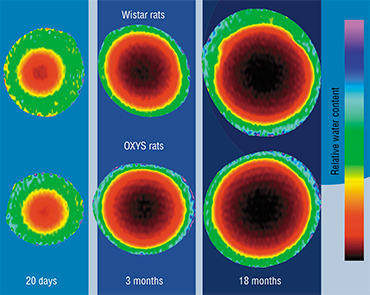 Magnetic resonance studies of smaller molecule transport in the lens of Wistar rats and in senescence-accelerated OXYS rats created in the SB RAS Institute of Cytology and Genetics in Novosibirsk, yielded surprising results. It turned out that in eyes affected by age and cataracts, the content and diffusion speed of water and other small molecules remain unchanged. It is possible that changes in the content levels of such compounds as aminoacids and molecular UV filters, is explained by the existence of a barrier that stops larger molecules. Based on: (Dobretsov, Snytnikova, Koptyug, 2013)