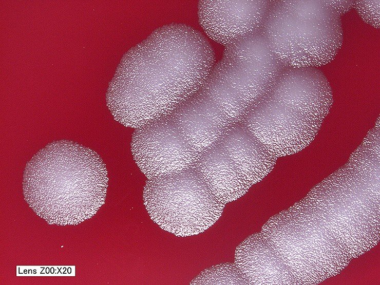 Эти колонии бацилл сибирской язвы Bacillus anthracis штамма Sterne Б, выращенные в течение суток на кровяном агаре при температуре 35 °С, имеют классическую структуру «матового стекла», напоминая груду мелких стеклянных осколков. Первоначально колонии имеют четко очерченные границы, а затем, продолжая расти, сливаются другу с другом. CDC, Public Domain