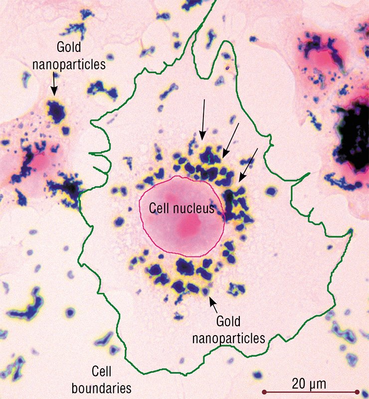 This cell of HeLa culture, growing on glass, takes up gold nanoparticles and accumulates them in its cytoplasm. Light microscopy, eosin staining