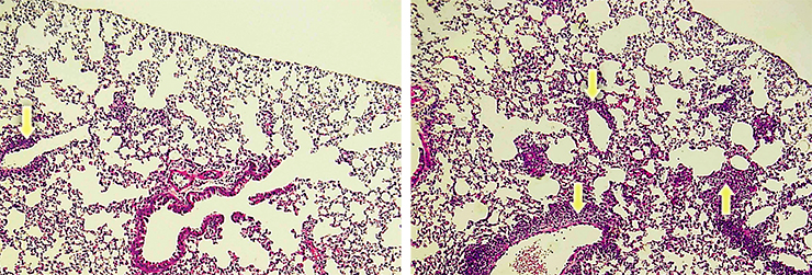 Запах «прекрасного пола» может усиливать у самцов не только превентивную защиту от респираторных инфекций, но и аллергическую реакцию. На фото: гистологические изменения в легких мышей с экспериментально спровоцированной аллергией. У самцов, получавших хемосигналы самок, инфильтрация эозинофилов («воспалительных» клеток крови) в область вокруг венозных сосудов (справа) выражена гораздо сильнее, чем у изолированных особей (слева). Гистологические исследования выполнены профессором Масао Оно (Кафедра гистопатологии, Университет Тохоку, Япония)