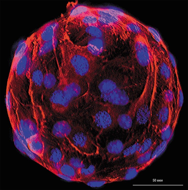 На фотографии, сделанной с помощью флуоресцентного микроскопа, показаны фидерные миобласты на поверхности микроносителей. Миобласты окрашены специальным веществом, выделенным из бледной поганки (Amanita phalloides), которое позволяет визуализировать цитоскелет (красный цвет). Ядра клеток окрашены в синий цвет с помощью специального красителя для ДНК