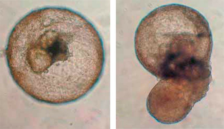 Эти так называемые эмбриоидные тельца получены в результате спонтанной дифференцировки эмбриональных стволовых клеток человека. Флуоресцентная микроскопия. Фото авторов