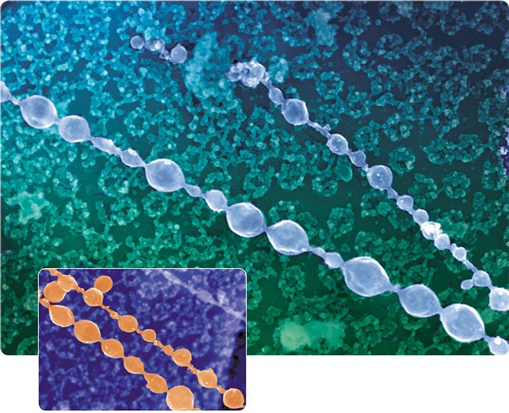 Цепочка мелких пузырьков ЭПР, в сплавлении которых, возможно, принимает участие ретикулон 4, на цитоплазматической поверхности ядерной оболочки ооцита лягушки