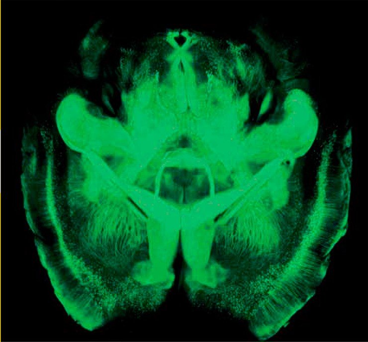 С помощью технологии CLARITY мозг этой лабораторной мыши удалось сделать прозрачным, удалив из клеточных мембран липиды, рассеивающие свет, и заполнив промежутки прозрачным гелем, формирующим прочную «сетку»