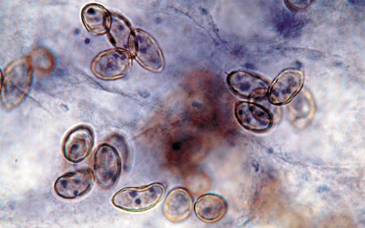 На сегодняшний день единственным достоверным диагностическим признаком описторхоза является наличие яиц паразита в желчи или фекалиях. Световая микроскопия. Фото А. Кривопалова (ИСиЭЖ СО РАН)