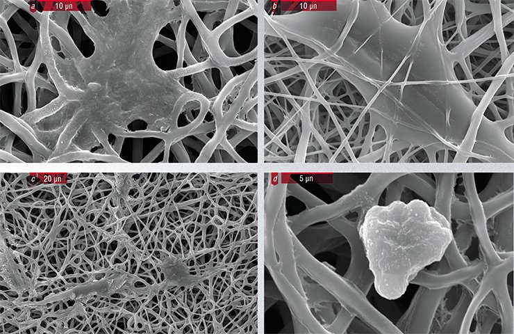 Human primary endothelial cells (a–d) and human fibroblasts (e–h) are successfully cultivated on the surface of electrospun matrices made of different polymers: (a, d) matrix of polycaprolactone; (b, e) matrix of polycaprolactone + 10 % gelatin; (c, g) matrix of polylactide-co-glycolide; (d, h) matrix of nylon-6. Scanning electron microscopy. Photo 	by the courtesy of N. Rudina