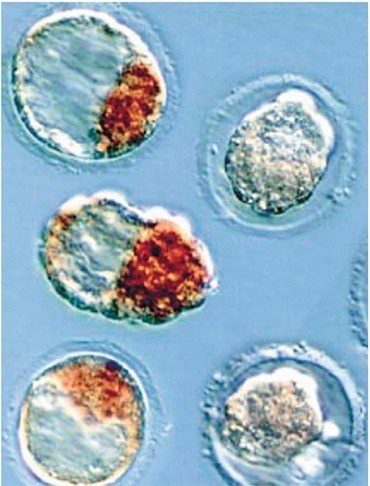 Бластоциста – ранняя (4–5 дней после зачатия) стадия развития эмбриона у млекопитающих, включая человека. Коричневым цветом выделена часть бластоцисты, из которой развивается будущая особь и из которой получают эмбриональные стволовые клетки для дальнейшего культивирования. Фото из архива лаборатории генетики развития ИЦиГ СО РАН