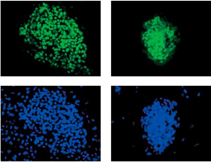 Зеленое свечение этих индуцированных плюрипотентных стволовых клеток подтверждает, что в них экспрессируется ген NANOG – основной маркер плюрипотентности стволовых клеток, т. е. способности дифференцироваться во множество специализированных типов клеток. Синим цветом окрашены ядра клеток. Флуоресцентная микроскопия. Фото А. И. Шевченко и И. С. Захаровой