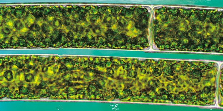 Фрагмент нити спирогиры (вверху) и фрагмент нити кладофоры гломераты (внизу). Световая микроскопия
