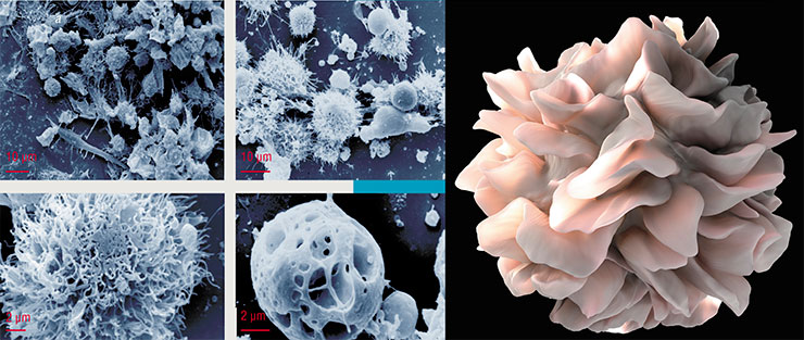 Миелоидные дендритные клетки образуются из костномозговых гемопоэтических клеток-предшественников. В лабораторных условиях их можно получить из моноцитов периферической крови. Слева – зрелые (a, b) и апоптотические/некротические (c, d) дендритные клетки. © CC BY-SA 3.0/ J. Neumüller, S. E. Neumüller-Guber, J. Huber, A. Ellinger, T. Wagner. Справа – модель дендритной клетки человека, на поверхности которой находятся пластинчатые отростки, которые могут складываться обратно на мембрану. © NIH/ NCI/D. Bliss, S. Subramaniam