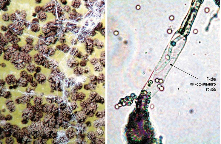Слева – белая «паутина» на поверхности колонии гриба р. Aspergillus – мицелий паразитического микофильного гриба. Справа – гифа микофильного гриба внутри кондиеносца Aspergillus. Световая микроскопия
