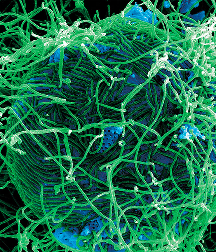 Вирусы – это неклеточные инфекционные агенты. Вверху – модель вызывающего респираторные инфекции аденовируса 5-го типа, сделанная из пластика и картона в середине 1970-х гг. © CC BY 4.0/Science Museum, London