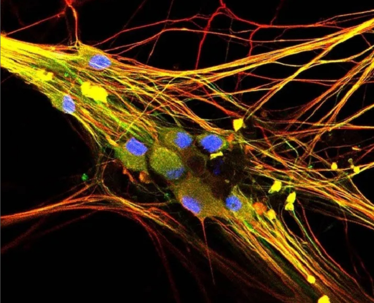 Сенсорные нейроны. Public domain/NCCIH/NIH