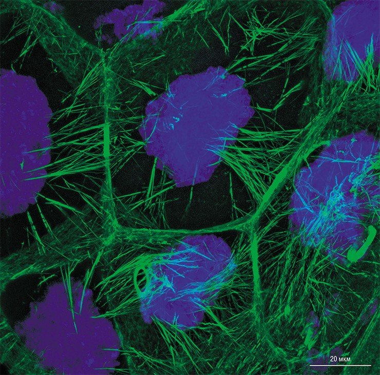 В норме в питающих клетках яйцевой камеры дрозофилы актиновые нити-филаменты протягиваются от стенок к ядрам, образуя сплетения, и удерживают последние вдали от кольцевых канальцев. Поскольку через эти канальцы происходит ток цитоплазмы из питающих клеток в растущий ооцит, очень важно, чтобы их просвет оставался свободным. Синим цветом окрашены ядра питающих клеток, зеленым – актиновые филаменты