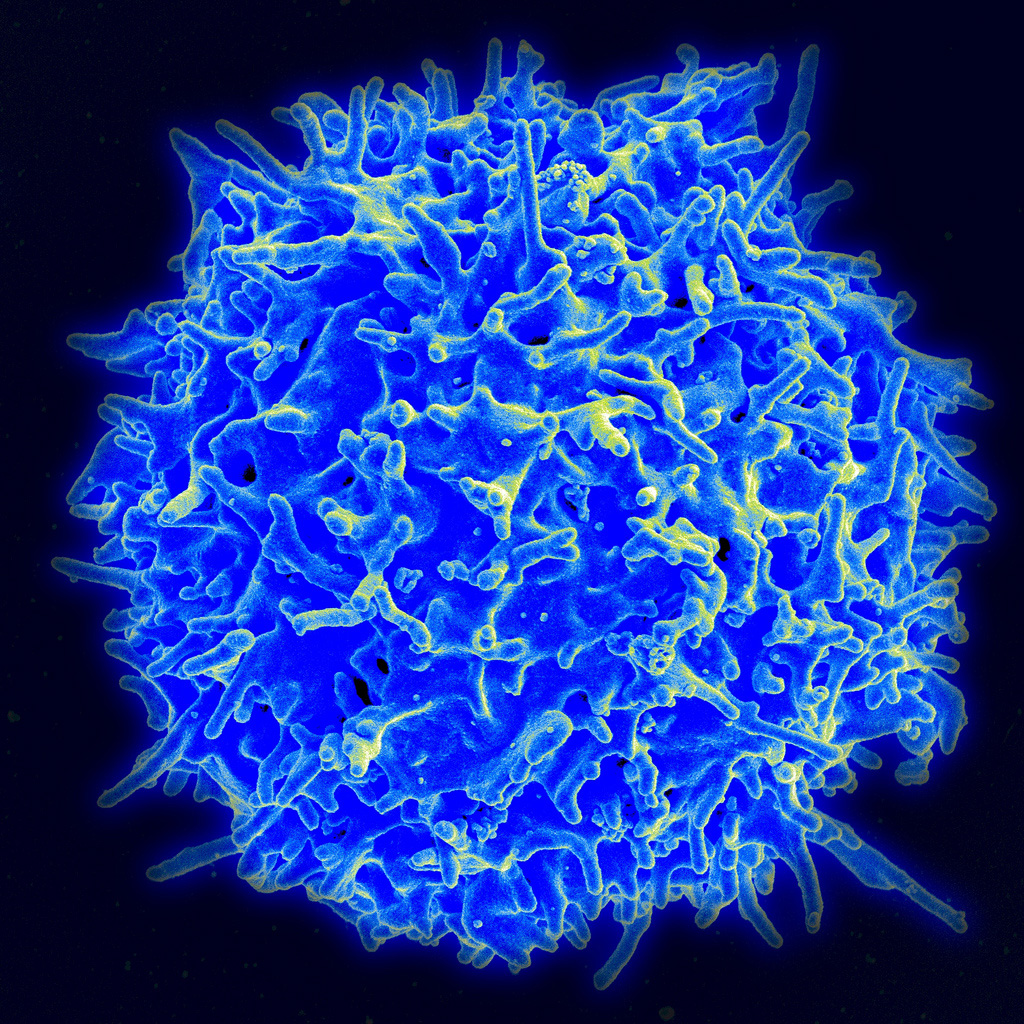Человеческий Т-лимфоцит – одна из важнейших составляющих нового иммунного оружия против раковых клеток. Растровая микроскопия. © National Institute of Allergy and Infectious Diseases, USA