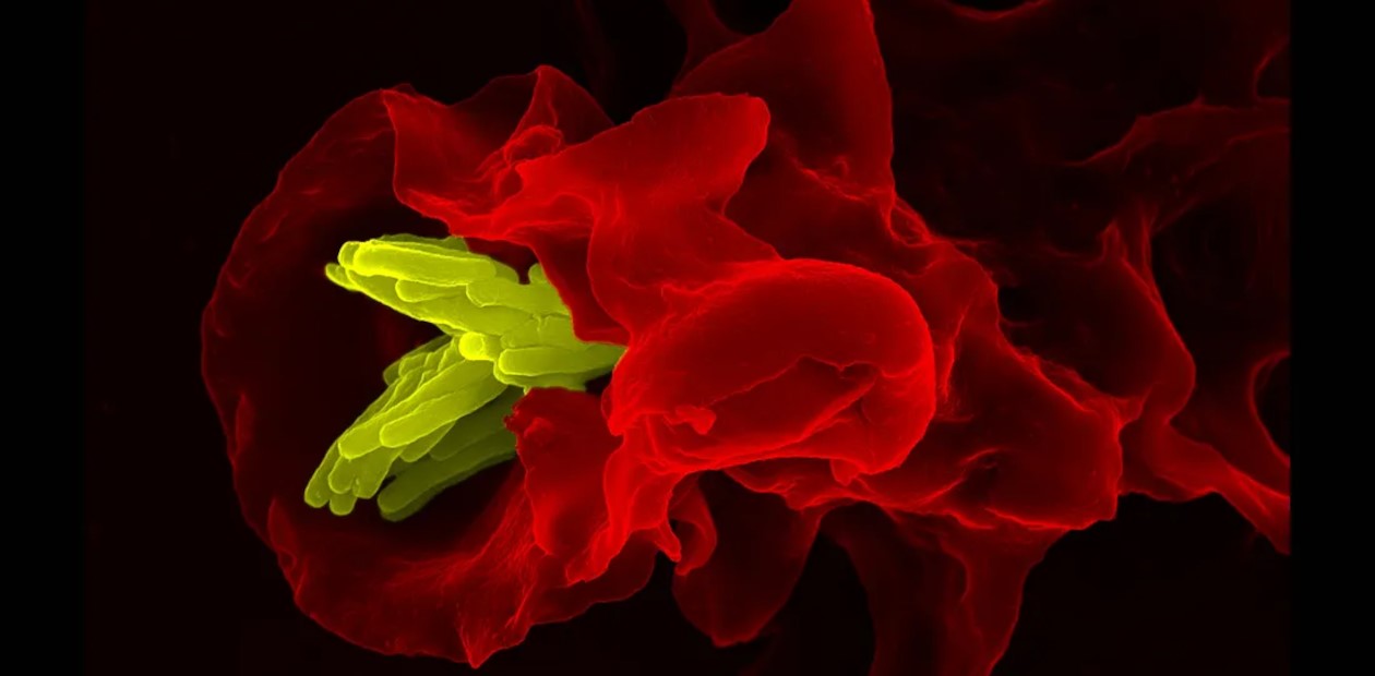 Макрофаг, поглощающий патоген (желтым цветом). © CC BY-NC-ND 2.0/ZEISS Microscopy