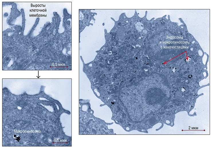 Уже через 10 минут после инъекции наночастиц золота в перитонеальную полость мышей около 80 % опухолевых клеток гепатомы А содержали наночастицы: клетки работали буквально как «выжатые губки» (справа). Для этих клеток характерен макропиноцитоз – неспецифический способ поглощения вещества (слева). Просвечивающая электронная микроскопия 