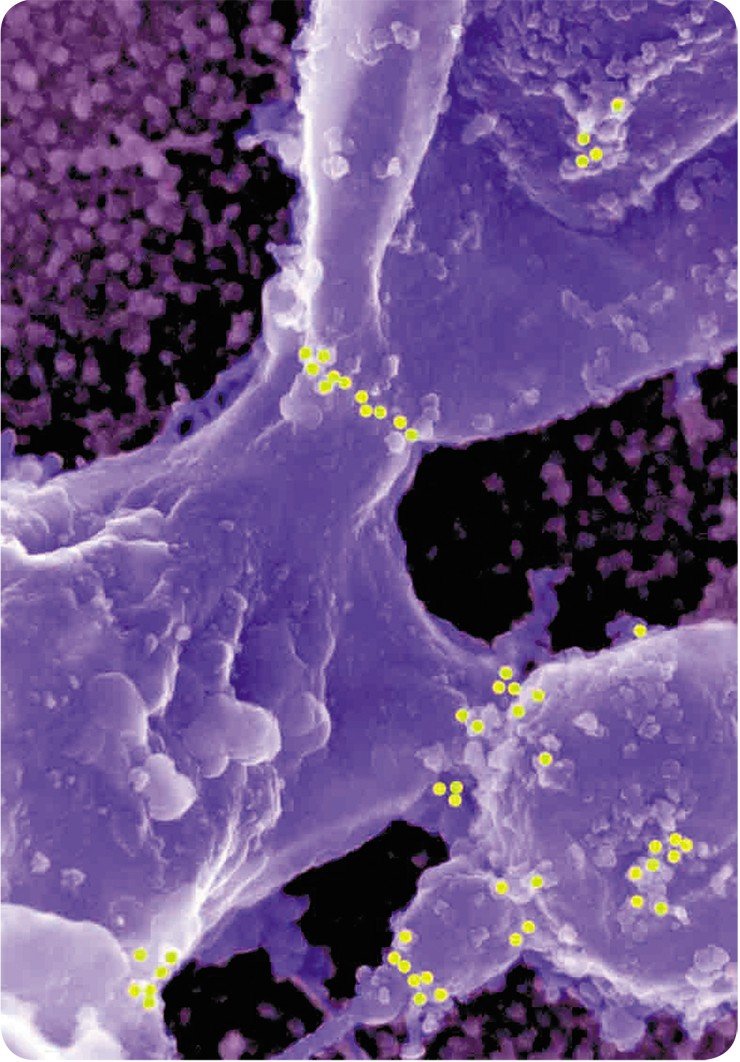 «Место встречи изменить нельзя». Локализация белка ретикулона в участках слияния пузырьков эндоплазматического ретикулума. Белки ретикулоны обнаружены во всех эукариотах и являются интегральными мембранными белками, т. е. встроены в клеточные мембраны. Известны четыре гена, кодирующиХ ретикулоны 1, 2, 3 и 4. В 2006 г. американскими исследователями было установлено, что белок ретикулон 4 (NogoA в другой транскрипции) может изменять кривизну мембран ЭПР в условиях in vitro (в пробирке) и превращать его компоненты в микротрубочки. Мы впервые продемонстрировали в условиях in vivo, что этот белок локализуется в участках сплавления компонентов (пузырьков) ЭПР друг с другом, а также в участках сплавления компонентов ЭПР с наружной мембраной ядерной оболочки. Это предполагает важную роль ретикулона 4 в сборке новых фрагментов ядерной оболочки. Эти данные опубликованы нами в 2007 г. в J. Struct. Biol. Поскольку этот белок принимает участие в развитии болезни Альцгеймера (показано, что он ингибирует рост аксонов в нервных клетках), то исследование функций этого белка представляет большой научный интерес