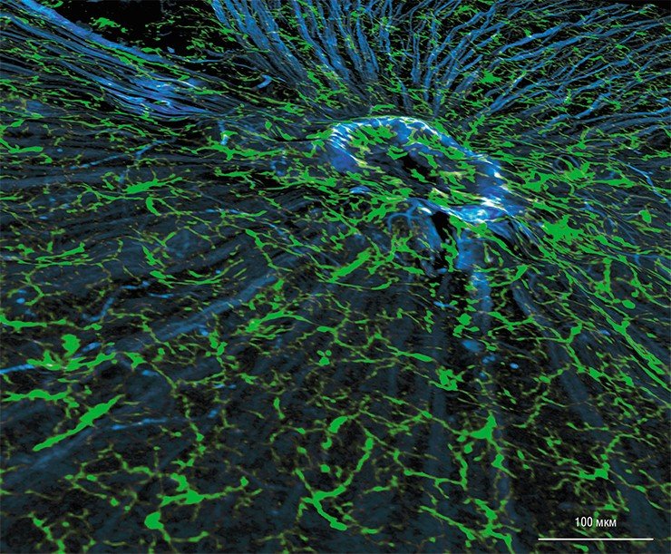На поверхности сетчатки глаза мыши нервные волокна (синяя окраска) сходятся в головке зрительного нерва, направляясь в мозг в составе зрительного нерва. Клетки микроглии (зеленая окраска), покрывающие сетчатку, следят за состоянием здоровья близлежащих отростков нервных клеток. Конфокальная микроскопия. Фото авторов с сайта Федерации американских обществ экспериментальной биологии (FASEB), победители конкурса Био-Арт 2012 