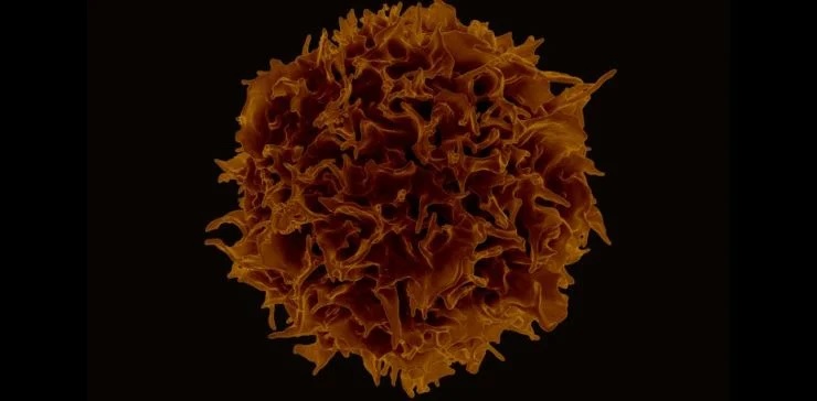 Т-лимфоцит. Сканирующая электронная микроскопия. Credit: NIAID