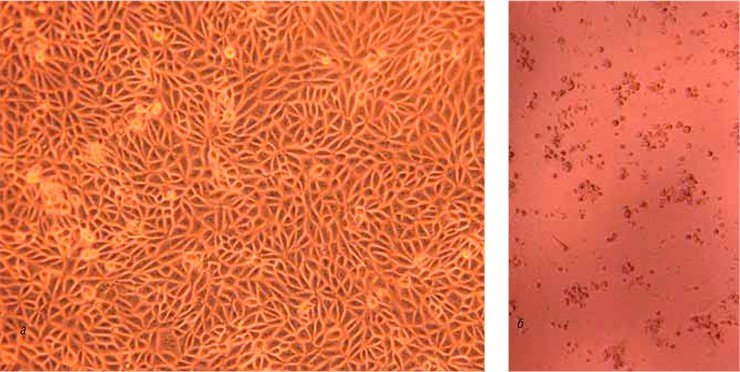 По действию на клетки вирус диареи крупного рогатого скота делится на цитопатогенный и нецитопатогенный биотипы. Цитопатогенный вирус индуцирует в клетках явление апоптоза (самоуничтожения; а), нецитопатогенный сохраняет жизнеспособность клеток (б). На фото – перевиваемая культура клеток коронарных сосудов теленка, инфицированная  разными биотипами ВД КРС