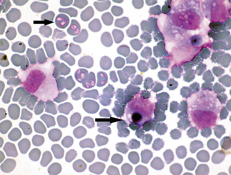 Blood of a dog from South Africa contains different causative agents of infections transmitted by the tick Rhipicephalus sanguineus: babesia protozoans in erythrocytes and ehrlichia bacteria in leukocytes. © CC BY 3.0, photo by Alan R Walker