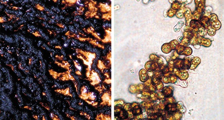 Многие грибы-микромицеты содержат темный пигмент меланин и являются потенциальными продуцентами этого биологически активного вещества. На фото – колония и почкующиеся конидии гриба р. Aureobasidium из рассева пробы воздуха. Световая микроскопия