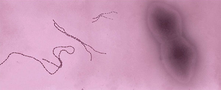 Некоторые кишечные бактерии способны напрямую влиять на настроение человека. К ним относятся представители родов Coprococcus и Dialister, причастные к метаболизму «гормона радости» дофамина. Слева – цепочки клеток бактерии C. eutactus. Public domain /CDC / Dr. V. R. Dowell. Справа – парные клетки недавно открытой кишечной бактерии D. massiliensis. По: (Afouda et al., 2020)