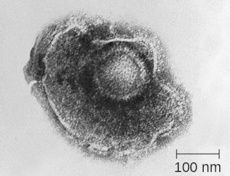 Возбудитель ветряной оспы и опоясывающего лишая – вирус Варицелла-Зостер, относящийся к вирусам герпеса человека 3-го типа.  Трансмиссионная электронная микроскопия 